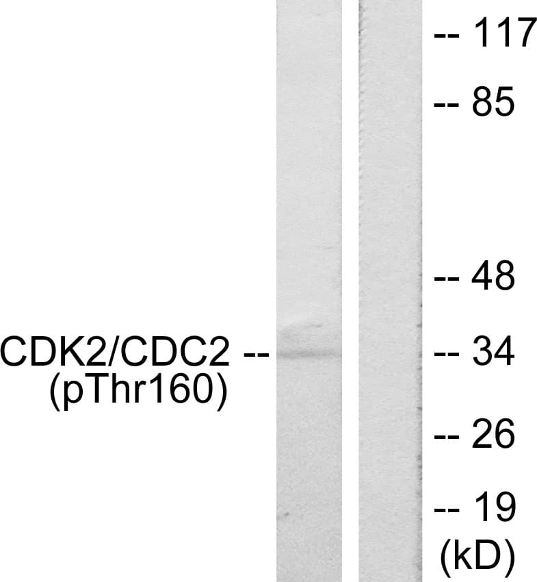 Polyclonal Rabbit anti-Human CDK2 Antibody (phospho-Thr160, IHC, WB)