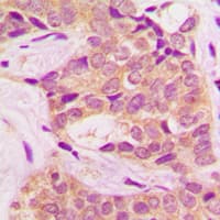 CML / BCR Antibody (phospho-Tyr360)