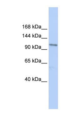 Polyclonal Rabbit anti-Human TRPC3 Antibody (N-Terminus, IHC, WB)