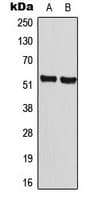 CCNA1 / Cyclin A1 Antibody (C-Terminus)