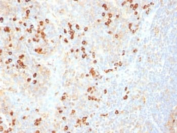 Plasma Cell Antibody (clone SPM310)