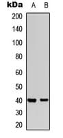 MAP2K3 / MEK3 / MKK3 Antibody (phospho-Thr222)