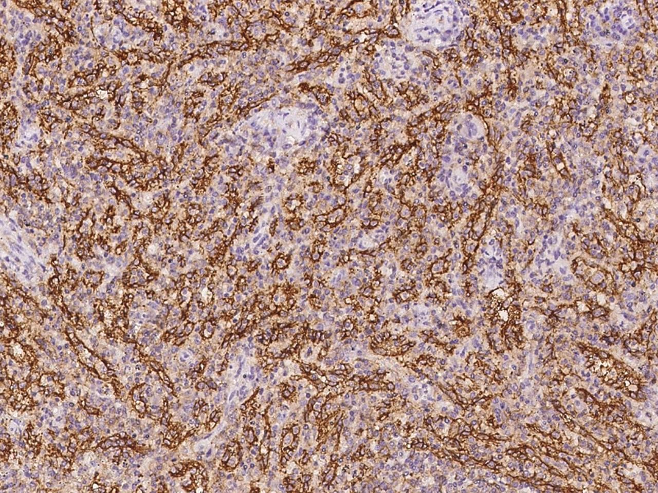 Polyclonal Rabbit anti-Human PLEKHO2 Antibody (IHC)