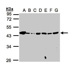 Polyclonal Rabbit anti-Human Mannose Phosphate Isomerase Antibody (aa150-423, IHC, WB)