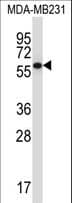 PPP2R5C Antibody (aa465-494)