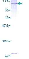Human MTHFD1 Protein (Recombinant GST)