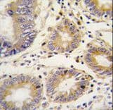 LEFTYB / LEFTY1 Antibody (aa283-314)