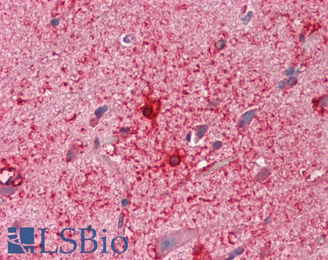PTCH2 / Patched 2 Antibody (aa362-411)