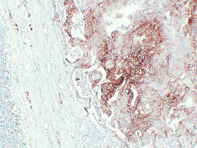 SLC2A1 / GLUT-1 Antibody (clone ABT-GLUT1)