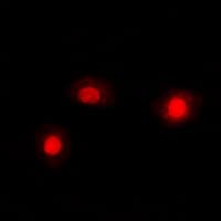 CFL1 / Cofilin Antibody (Internal)