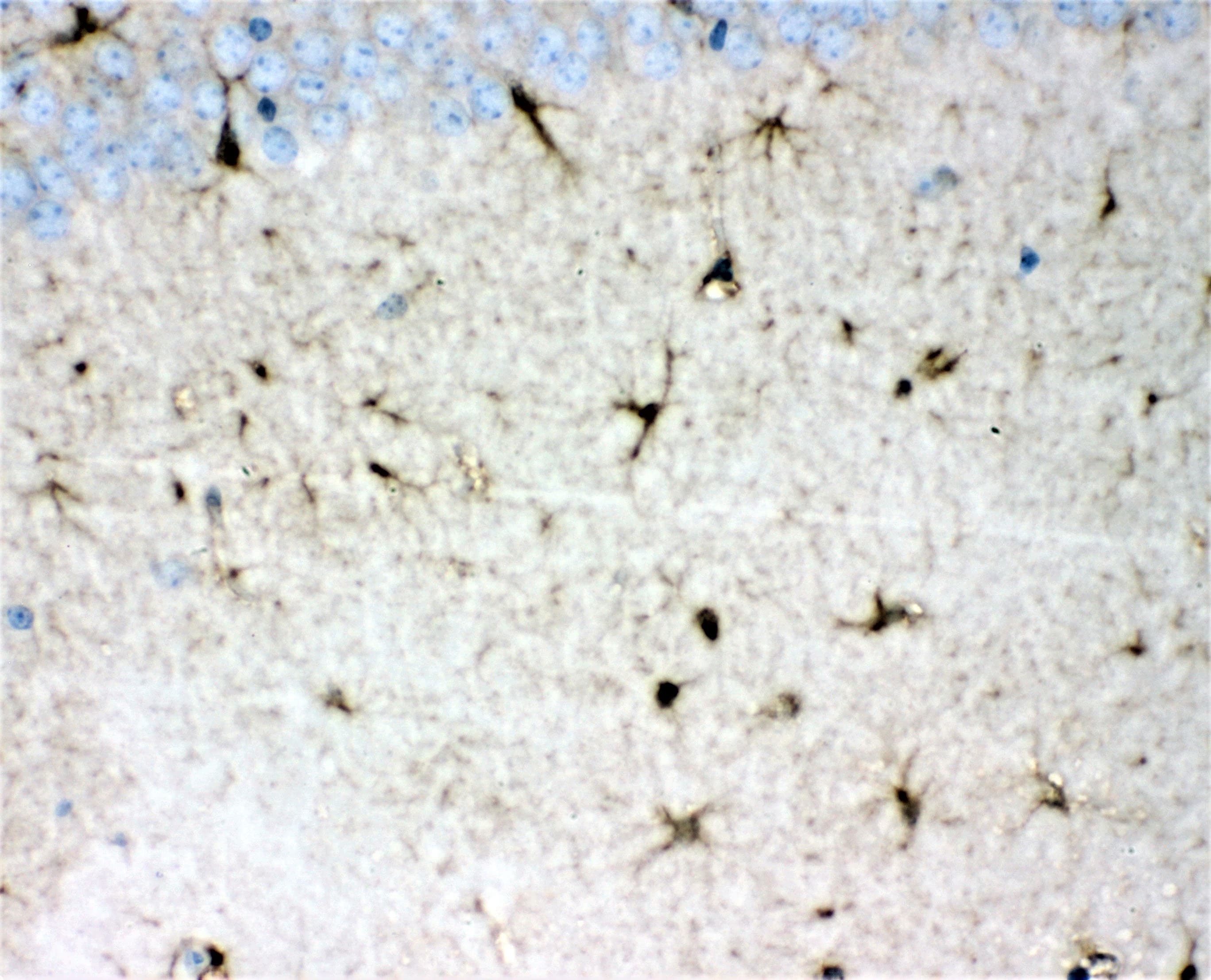 Polyclonal Rabbit anti-Human DDAH1 Antibody (WB)