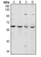 Polyclonal Rabbit anti-Human Cdc14 / CDC14A Antibody (WB)
