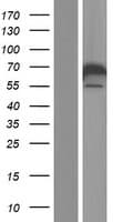 Human CACNB1 Protein (Over-Expression Lysate Myc-DDK (Flag))