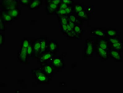 Polyclonal Rabbit anti-Human SUMO3 Antibody (IHC, IF)