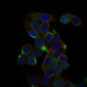 CD59 Antibody (Amino Acid: 31-111, clone 8D2B8)