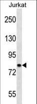 CACNB2 Antibody (aa232-261)