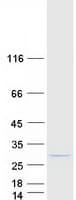 Human COMMD5 Protein (Recombinant Myc-DDK (Flag))