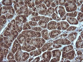 MAP2K1 / MKK1 / MEK1 Antibody (clone OTI4B1)