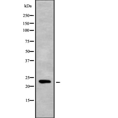 MOBKL2C / MOB3C Antibody