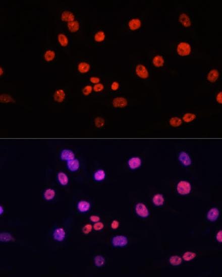 MYCT1 Antibody