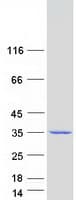 Human TPRG1L Protein (Recombinant Myc-DDK (Flag))