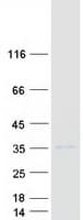 Human SPSB1 Protein (Recombinant Myc-DDK (Flag))