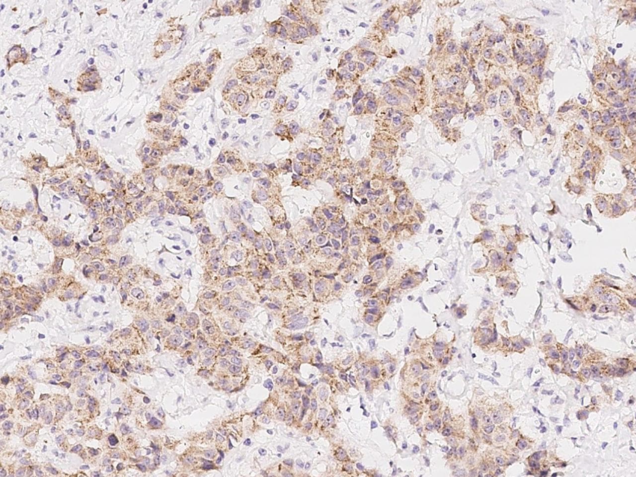 MCL1 / MCL 1 Antibody (Preservative Free)