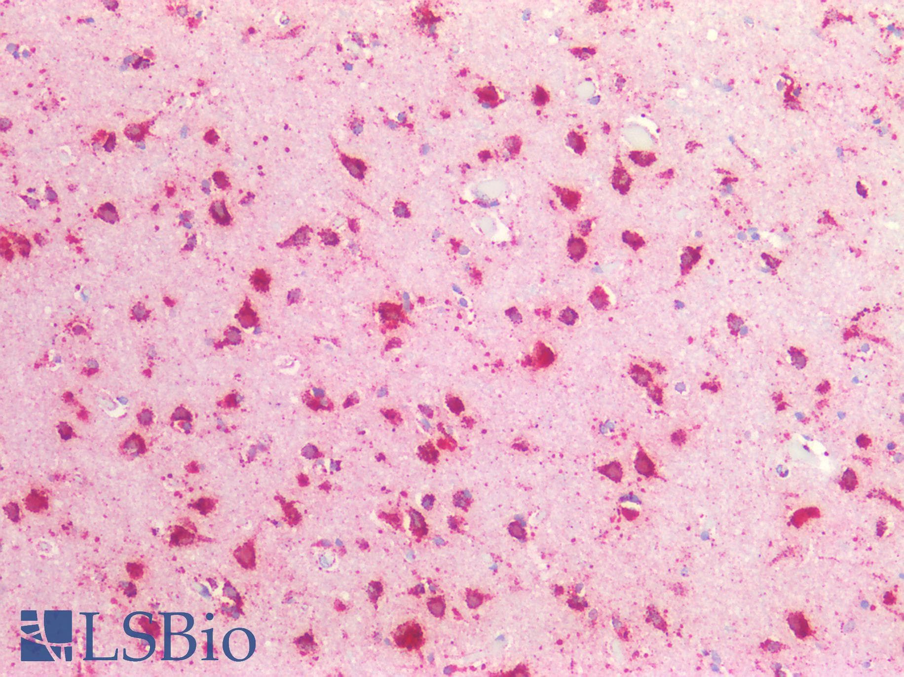 PathPlus™ CTSD / Cathepsin D Antibody (Internal)