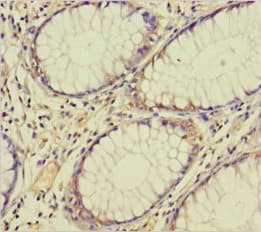 TAF12 Antibody (aa1-161)