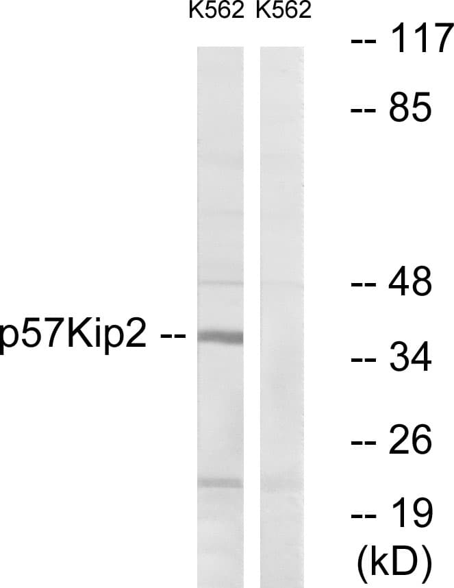 Polyclonal Rabbit anti-Human CDKN1C / p57 Kip2 Antibody (aa267-316, IF, WB)