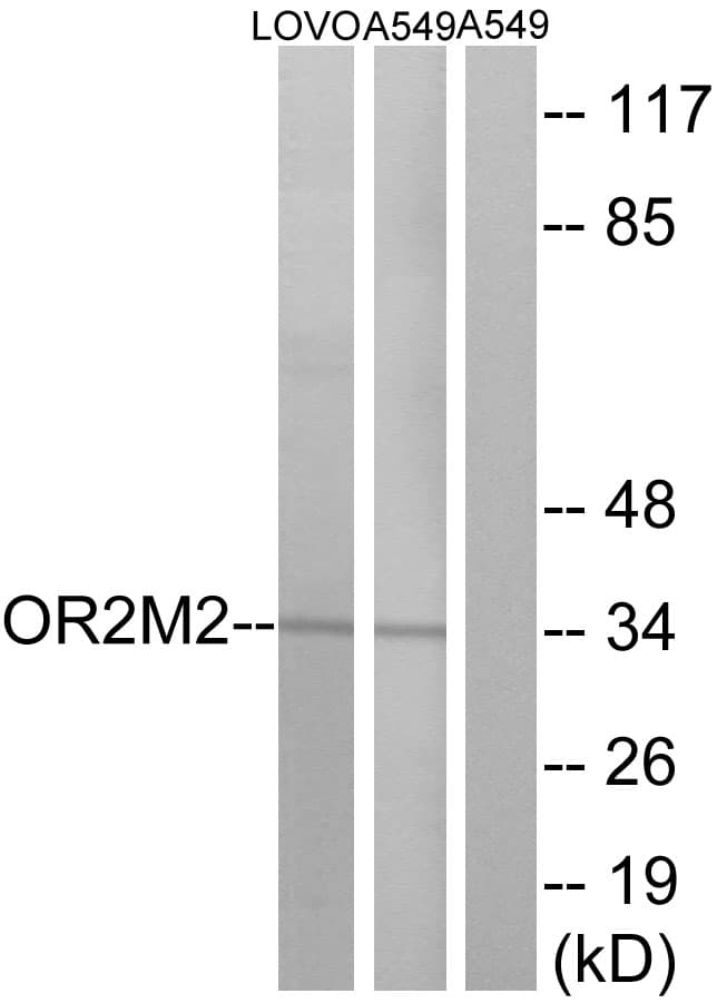 OR2M5 Antibody (aa281-330)