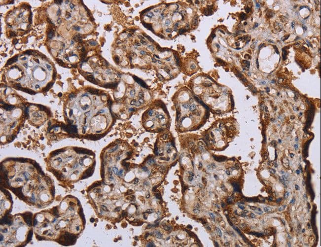 KIF1C Antibody