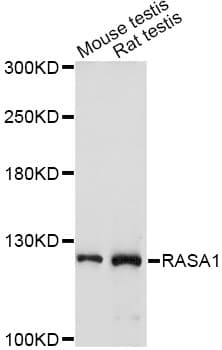 Polyclonal Rabbit anti-Human RASA1 Antibody (IHC, WB)