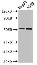 GLRA1/Glycine Receptor Alpha 1 Antibody