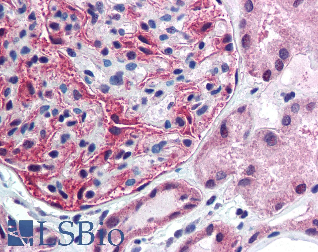 IHC-plus™ Polyclonal Rabbit anti-Human FANCF Antibody (Internal, IHC, WB)