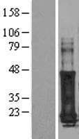 GAGE7 Protein (Over-Expression Lysate Myc-DDK (Flag))