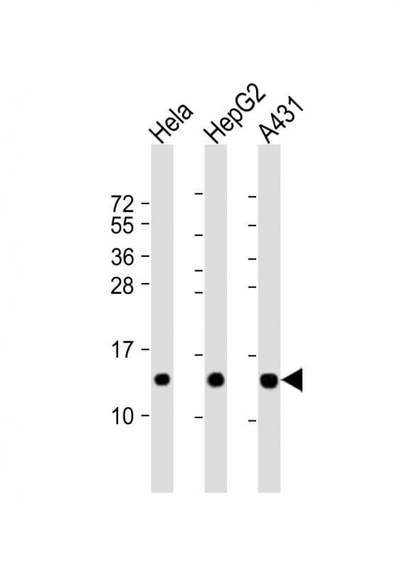 Polyclonal Rabbit anti-Human NDUFB3 Antibody (aa13-45, WB)