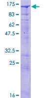 Human SYNJ2 / Synaptojanin 2 Protein (Recombinant GST)