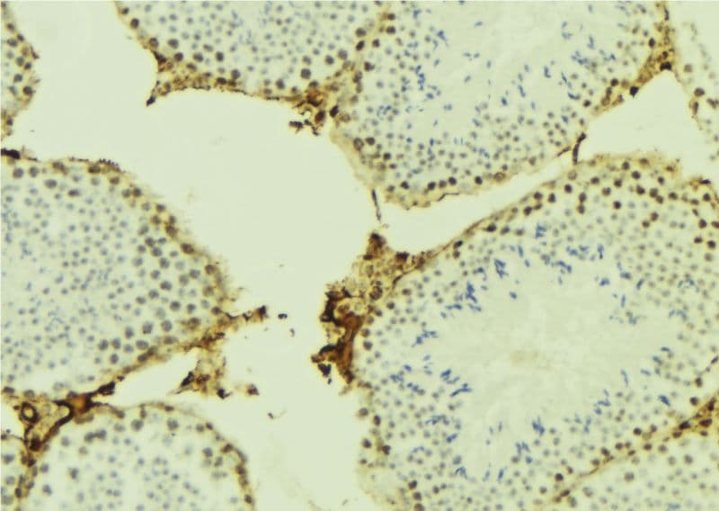 Polyclonal Rabbit anti-Human CDC45 Antibody (IHC, WB)