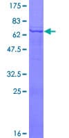 Human PDGF-D Protein (Recombinant GST)