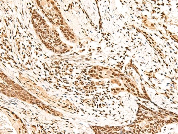 HOXC13 Antibody