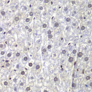 Polyclonal Rabbit anti-Human U2AF1 Antibody (IHC, WB)