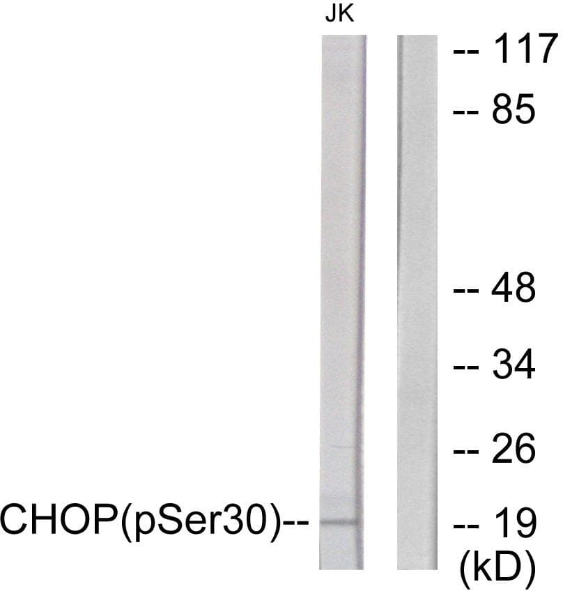 Polyclonal Rabbit anti-Human DDIT3 / CHOP Antibody (phospho-Ser30, IHC, IF, WB)