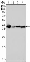 Monoclonal Mouse anti-Human NPM1 / NPM / Nucleophosmin Antibody (clone 7H10B9, IHC, IF, WB)