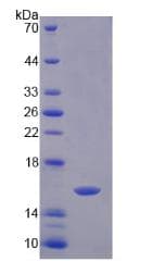 Mouse PK2 / PROK2 Protein (Recombinant His)