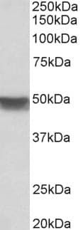 IHC-plus™ Polyclonal Goat anti-Human KRT20 / CK20 / Cytokeratin 20 Antibody (aa107-118, IHC, WB)
