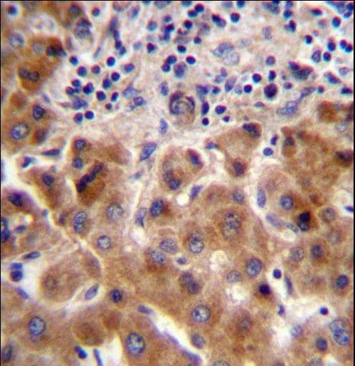 Polyclonal Rabbit anti-Human PSORS1C1 Antibody (aa13-42, IHC, WB)