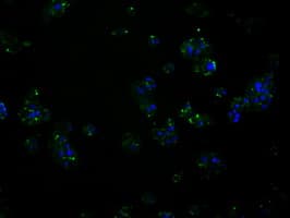 Monoclonal Mouse anti-Human RIP1 / RALBP1 Antibody (clone OTI2A6, IHC, IF, WB)