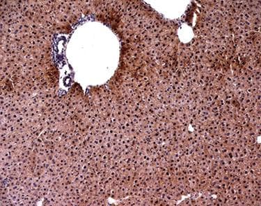 INSR / Insulin Receptor Antibody