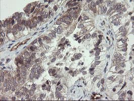 UBE2J1 Antibody (clone OTI1C7)